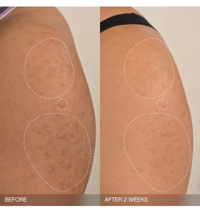 *SOBRE PEDIDO* Slather Exfoliating & Smoothing Bar (2 pack)