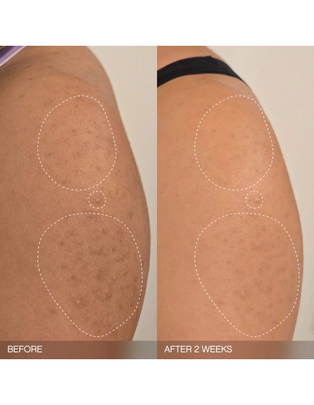 *SOBRE PEDIDO* Slather Exfoliating & Smoothing Bar (2 pack) *SOBRE PEDIDO* Slather Exfoliating & Smoothing Bar (2 pack)