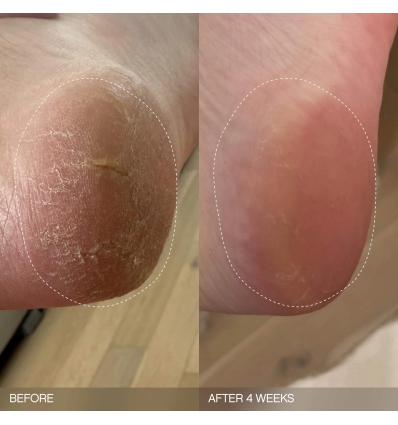 *SOBRE PEDIDO* Slather Exfoliating & Smoothing Bar (2 pack)