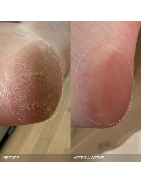 *SOBRE PEDIDO* Slather Exfoliating & Smoothing Bar (2 pack) *SOBRE PEDIDO* Slather Exfoliating & Smoothing Bar (2 pack)