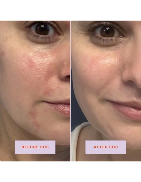 *SOBRE PEDIDO* SOS Daily Rescue Facial Spray *SOBRE PEDIDO* SOS Daily Rescue Facial Spray