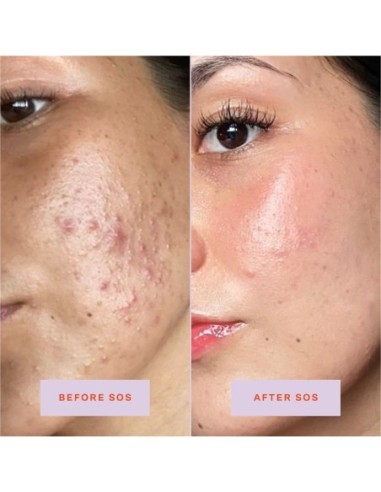 *SOBRE PEDIDO* SOS Daily Rescue Facial Spray