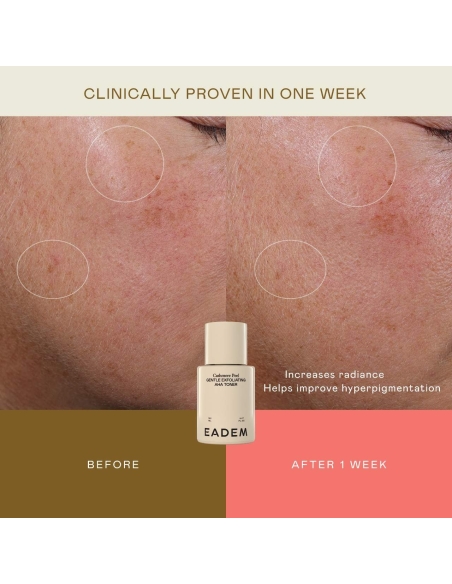 Cashmere Peel Gentle AHA + PHA Exfoliating Toner Cashmere Peel Gentle AHA + PHA Exfoliating Toner