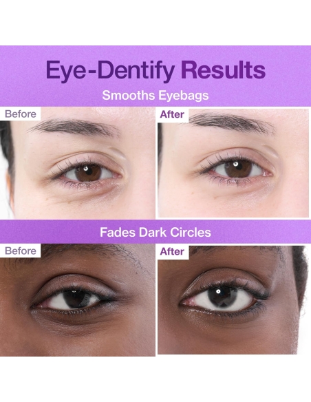 Numbuzin - No. 9 NAD Collagen Under Eye Patches Numbuzin - No. 9 NAD Collagen Under Eye Patches