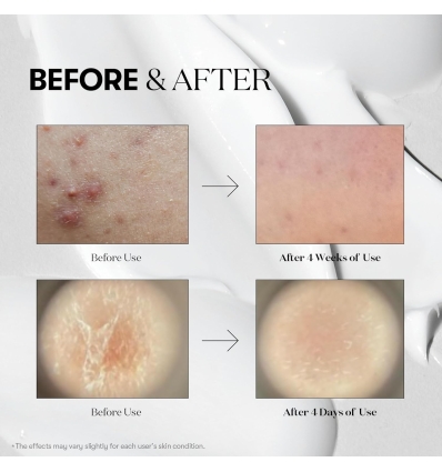 VT - Reedle Shot 100 Stick Pouch