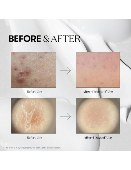 VT - Reedle Shot 100 Stick Pouch VT - Reedle Shot 100 Stick Pouch