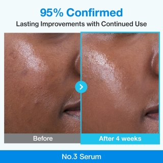 Numbuzin - No.3 Blue Bio-Retinol Pore Refining Serum 2