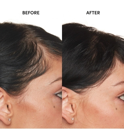 *SOBRE PEDIDO* Detox Shampoo & Scalp Serum Hair Set