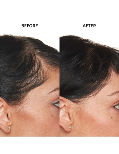 *SOBRE PEDIDO* Detox Shampoo & Scalp Serum Hair Set *SOBRE PEDIDO* Detox Shampoo & Scalp Serum Hair Set