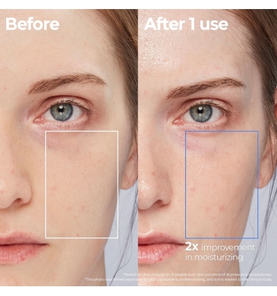 Aestura - Atobarrier 365 Lotion