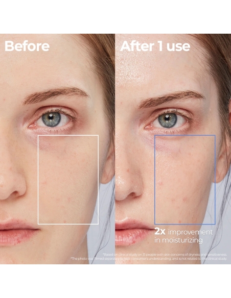 Aestura - Atobarrier 365 Lotion Aestura - Atobarrier 365 Lotion