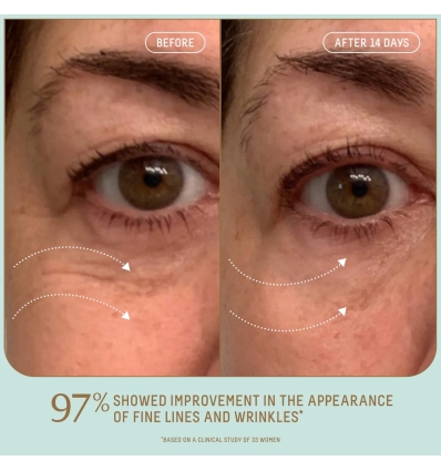 *SOBRE PEDIDO* Uplifting Glow Skincare Set