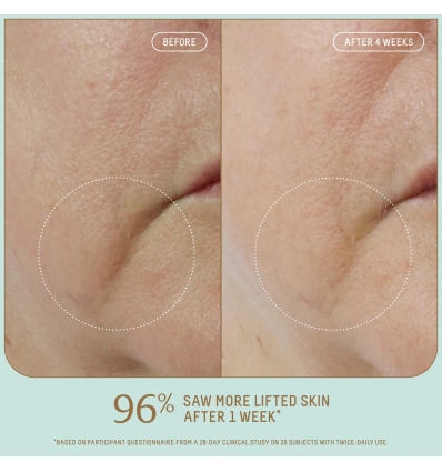 *SOBRE PEDIDO* Uplifting Glow Skincare Set