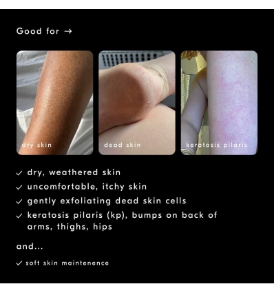 *SOBRE PEDIDO* Carea Cream Moisturizing + Softening Body Lotion