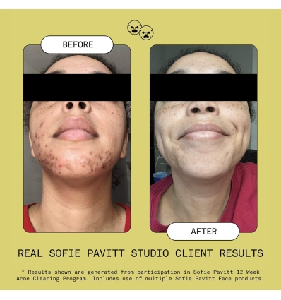 *SOBRE PEDIDO* Mandelic Acid Exfoliating & Clearing Serum