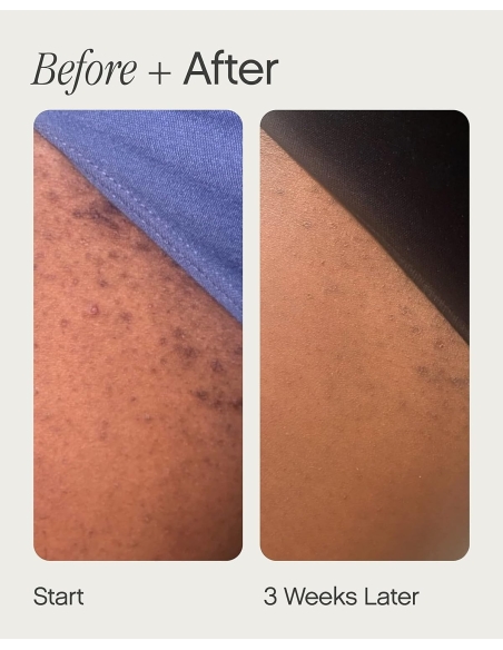 *SOBRE PEDIDO* High Roller Ingrown Hair Tonic *SOBRE PEDIDO* High Roller Ingrown Hair Tonic