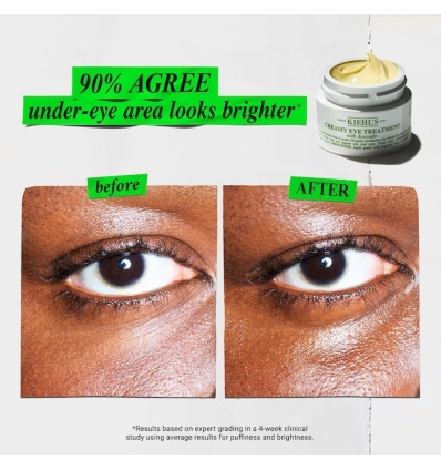 *SOBRE PEDIDO* Radiant & Replenished Eyes Gift Set