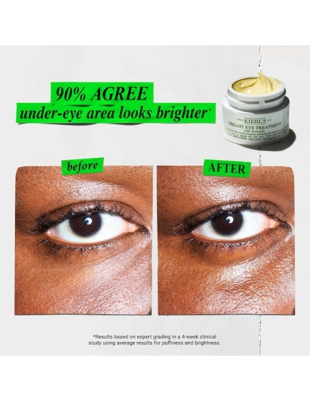 *SOBRE PEDIDO* Radiant & Replenished Eyes Gift Set