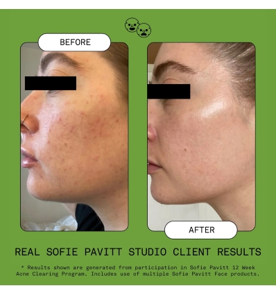 *SOBRE PEDIDO* Clean Clean Gentle Gel Foaming Cleanser