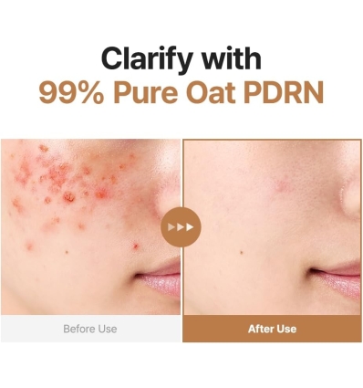 Purito - Oat PDRN Gentle Refining Toner