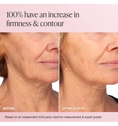 Extreme Cream Anti-Aging, Firming, & Lifting Moisturizer