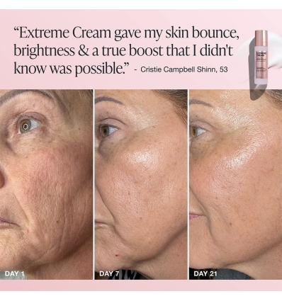 Extreme Cream Anti-Aging, Firming, & Lifting Moisturizer