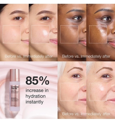 Extreme Cream Anti-Aging, Firming, & Lifting Moisturizer