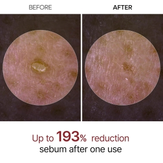 Dr.Melaxin - Peel Shot Glow Black Rice Peeling Ampoule 2