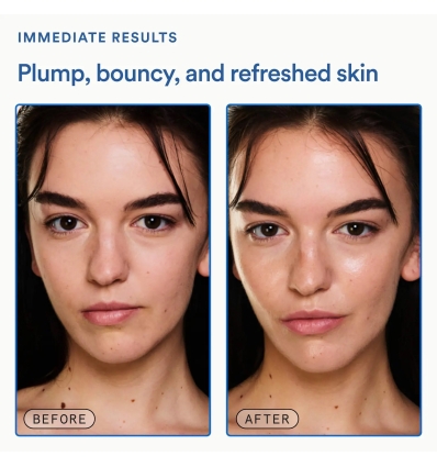 *SOBRE PEDIDO* Molecular Mesh Barrier Strengthening Moisturizer