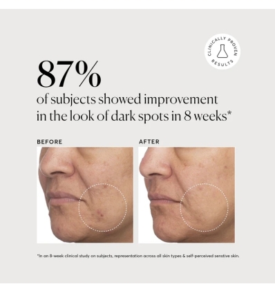 Tranexamic Topical Acid 5%