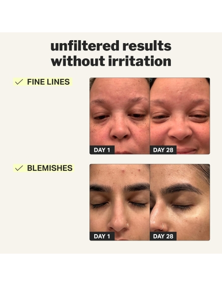 *SOBRE PEDIDO* Beginner Retinol Gel