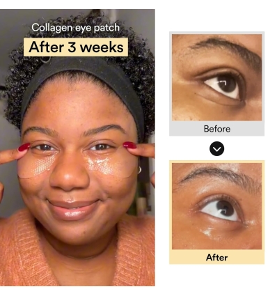 Collagen Eye Patch
