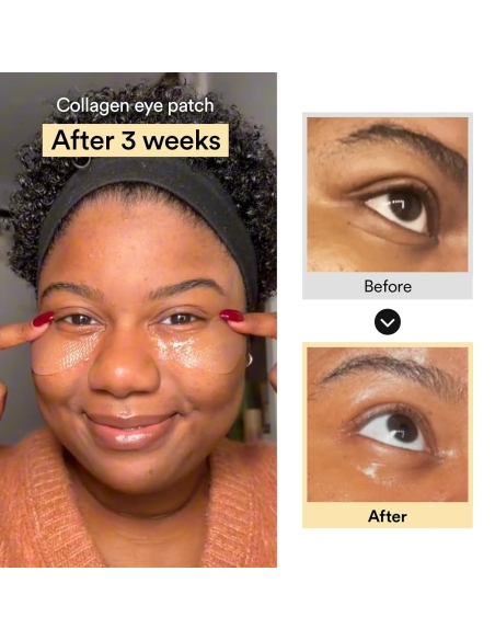 Collagen Eye Patch