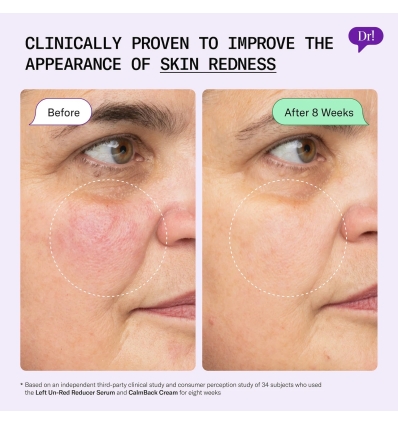 *SOBRE PEDIDO* Left Un-Red Reducer Face Serum