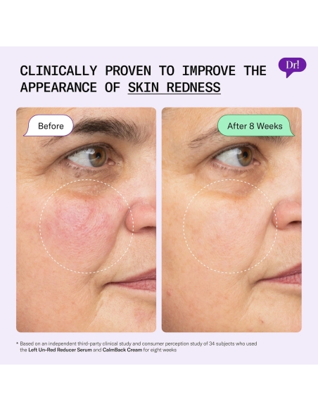 *SOBRE PEDIDO* Left Un-Red Reducer Face Serum