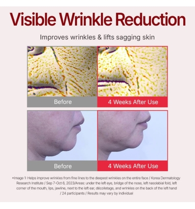 Centellian 24 - Madeca Cream Time Reverse