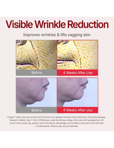 Centellian 24 - Madeca Cream Time Reverse