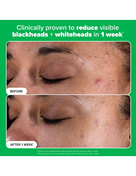 *SOBRE PEDIDO* Complexion Clarity Duo